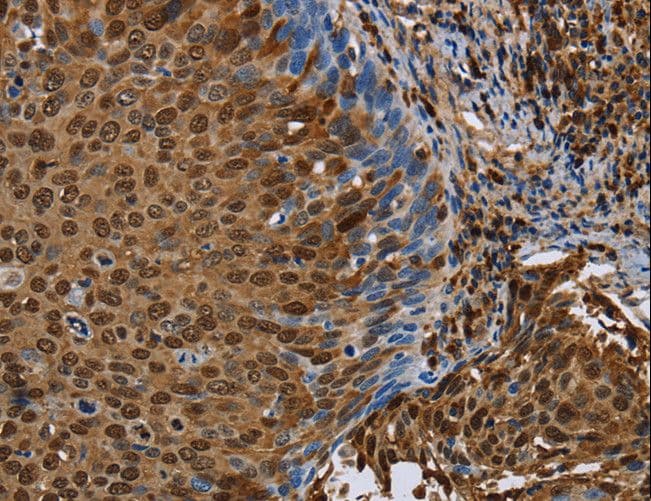 NRP2 / Neuropilin 2 Antibody