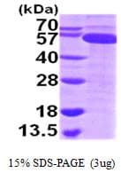 Human TRXR1 / TXNRD1 Protein (Recombinant His)