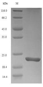 Mouse TREM2 / TREM-2 Protein (Recombinant 6His, N-terminus)