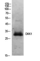 Polyclonal Rabbit anti-Human DKK1 Antibody (WB)