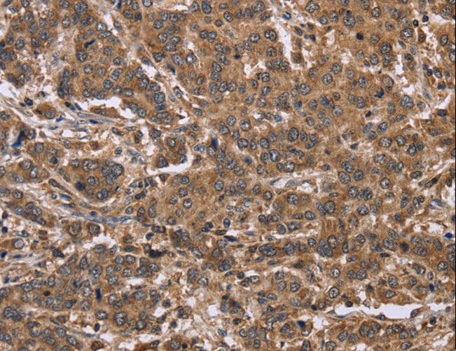 Polyclonal Rabbit anti-Human I-BABP / FABP6 Antibody (IHC)