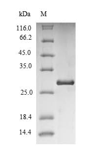 Human VPREB1 / CD179A Protein (Recombinant 6His-SUMO, N-terminus)