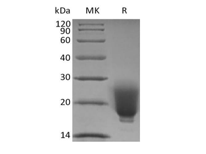 FNDC5 / Irisin Protein (Recombinant 6His, N-terminus)