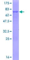 Human FDPS Protein (Recombinant GST)