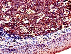 KLRD1 / CD94 Antibody