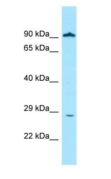 GLIPR1 / GLIPR Antibody (aa95-144)