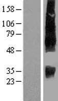 SLC13A2 / NaCT Protein (Over-Expression Lysate Myc-DDK (Flag))