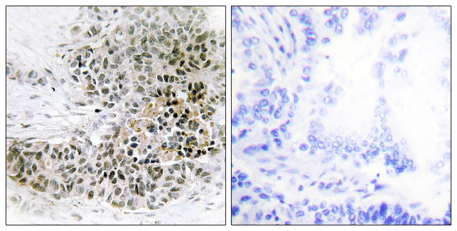 TRPS1 Antibody
