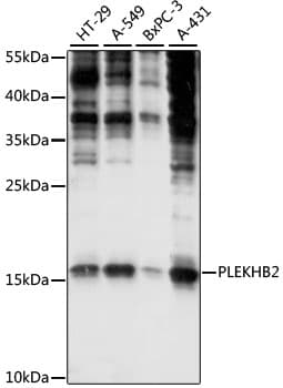 Polyclonal Rabbit anti-Human PLEKHB2 Antibody (WB)