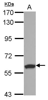 Polyclonal Rabbit anti-Human RSPRY1 Antibody (WB)