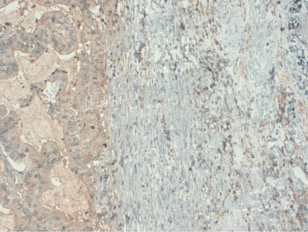 CA19-9 Antibody Antibody (clone 121SLE)