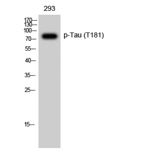 MAPT / Tau Antibody (440-520 aa)