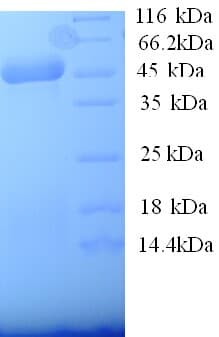 Human ACAA2 Protein (Recombinant His)