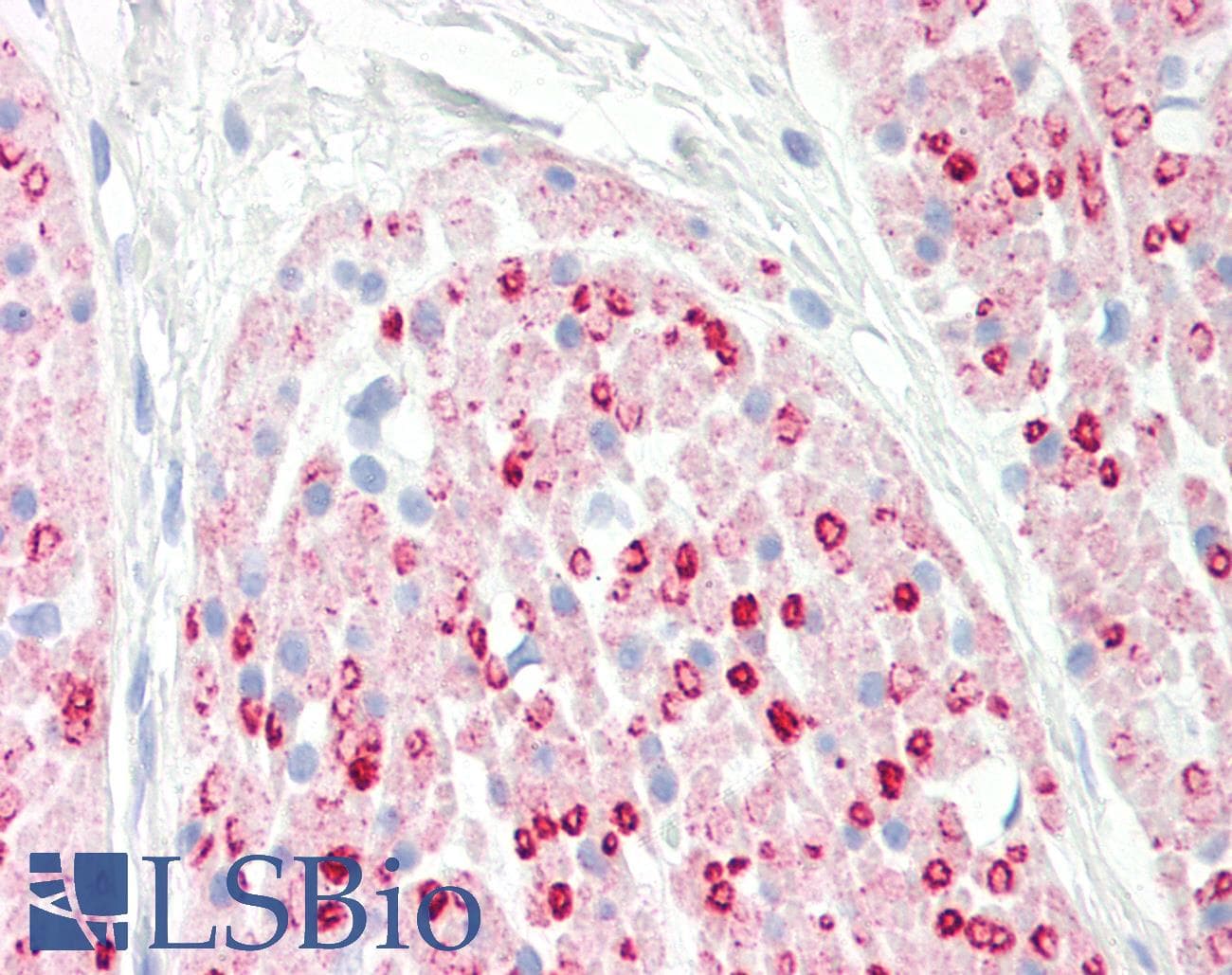 PathPlus™ Actin Antibody (clone ABT-ACTN)