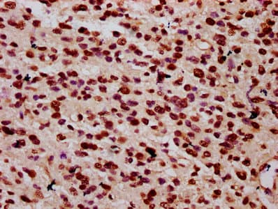HIST1H1C Antibody