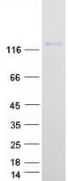 Human GAA / Alpha-Glucosidase, Acid Protein (Recombinant Myc-DDK (Flag))