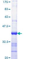 Human IQGAP1 Protein (Recombinant GST, N-terminus)
