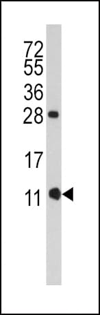 FKBP1B / FKBP12.6 Antibody (aa1-30)