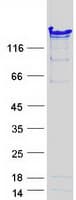 Human NASP Protein (Recombinant Myc-DDK (Flag))