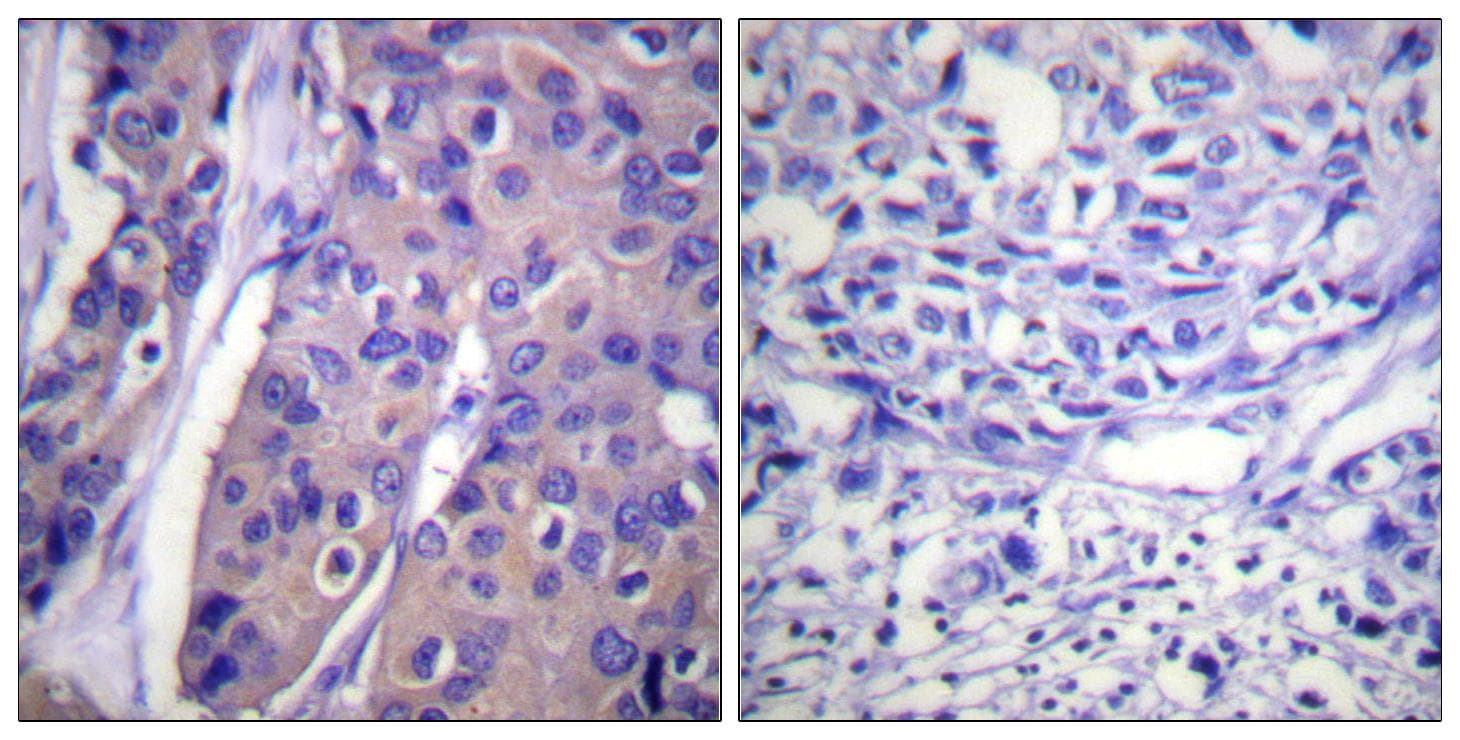 Polyclonal Rabbit anti-Human RAF1 / RAF Antibody (phospho-Ser296, IHC, WB)