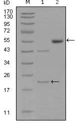 EPHA5 / EPH Receptor A5 Antibody (Amino Acid: 620-774, clone 8B10B1,8B10F5)
