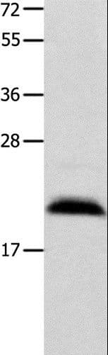 Polyclonal Rabbit anti-Human FGF12 Antibody (WB)