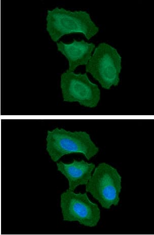 Monoclonal Mouse anti-Human ITGB1 / Integrin Beta 1 / CD29 Antibody (clone AT47E2, WB)