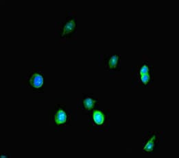 Polyclonal Rabbit anti-Human SMARCA4 / BRG1 Antibody (IHC, IF)