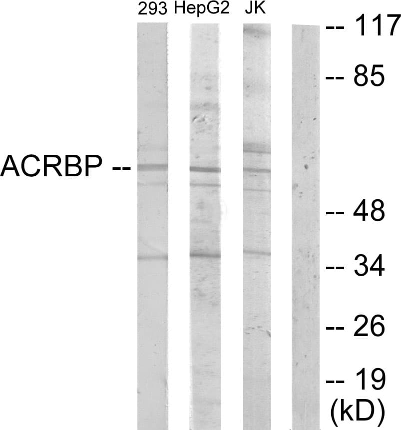 SP32 / ACRBP Antibody (aa181-230)