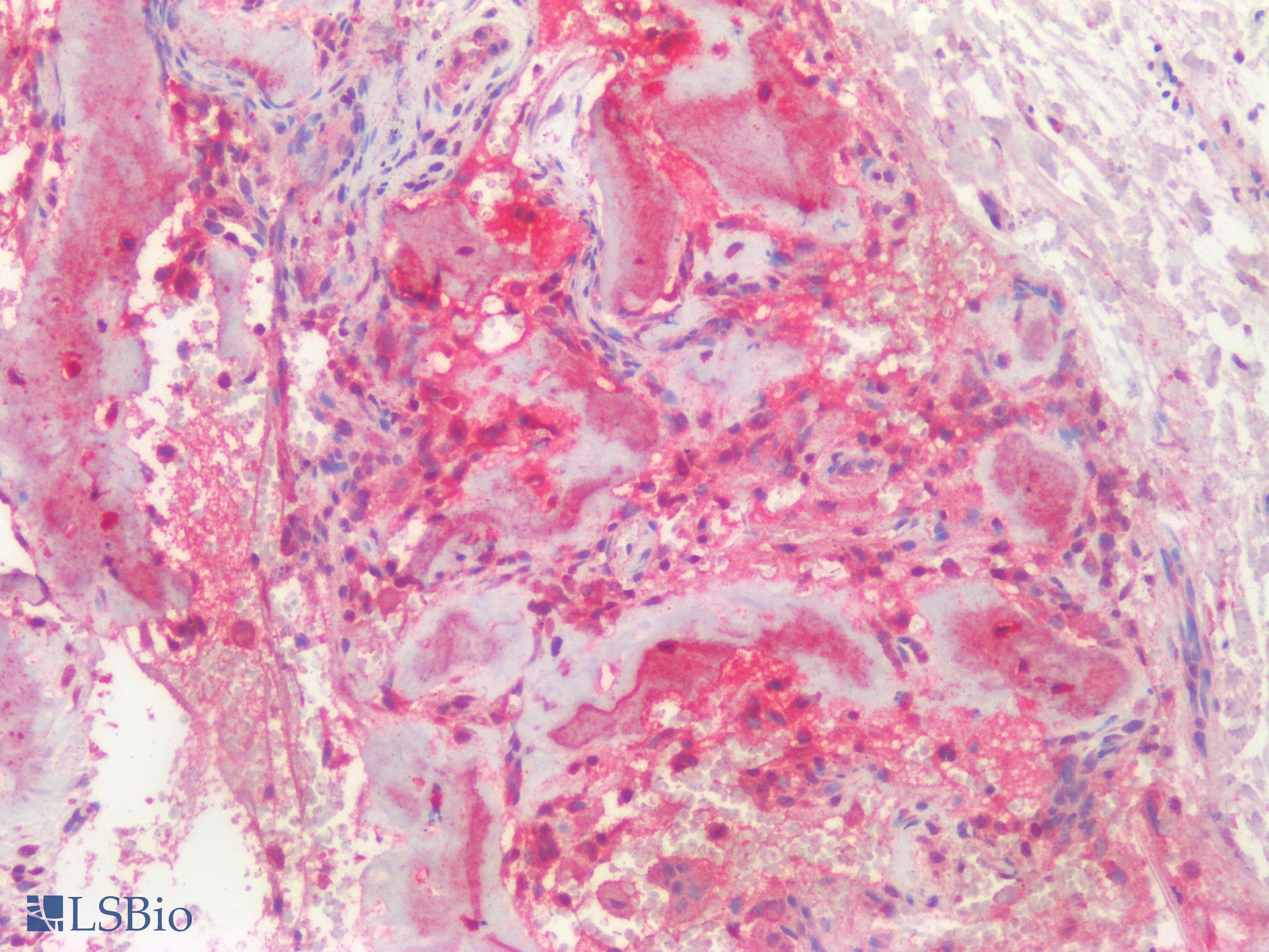 PathPlus™ Polyclonal Rabbit anti-Human Osteocalcin Antibody (IHC)