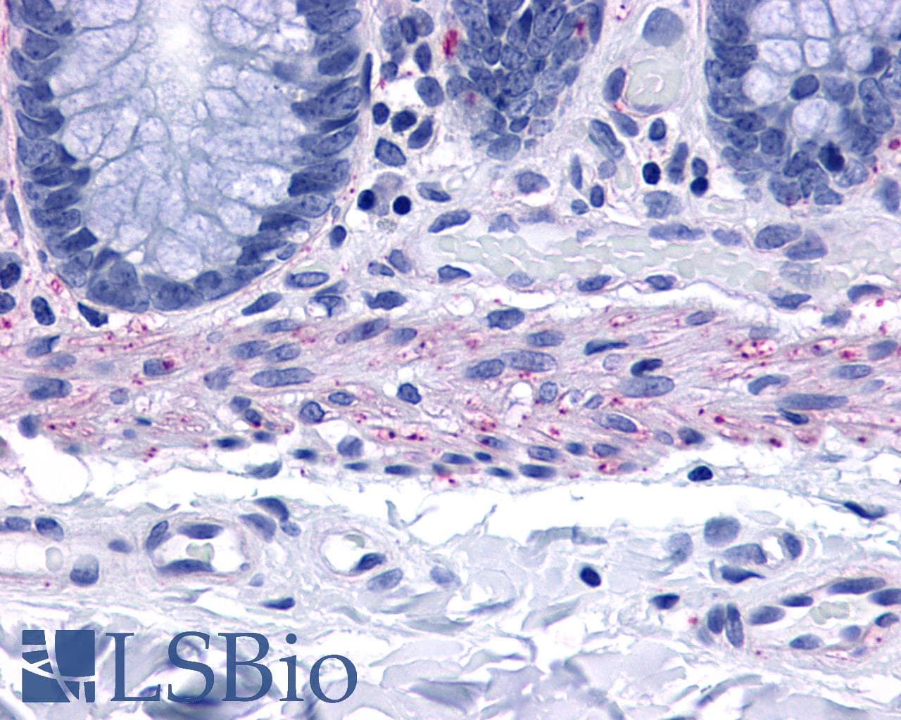 PathPlus™ TACR2 / NK2R Antibody (C-Terminus)