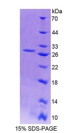 Mouse AFAP1 / AFAP Protein (Recombinant His-T7)