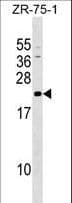 GRPEL1 Antibody (aa116-142)
