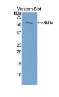 PRL / Prolactin Antibody (aa1-226)