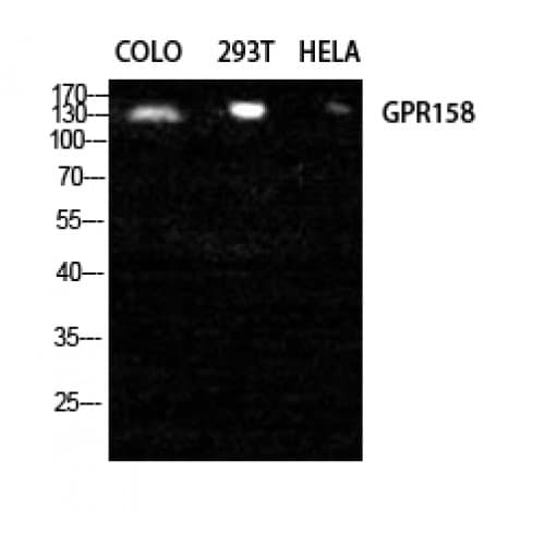 GPR158 Antibody (10-90 aa, N-terminal)