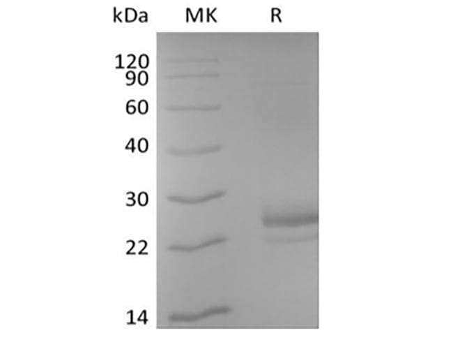 Human CD40L Protein (Recombinant 6His-AVI, N-terminus)