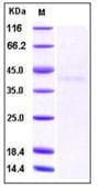 Human IL2RB / CD122 Protein (Recombinant His,C-terminus)