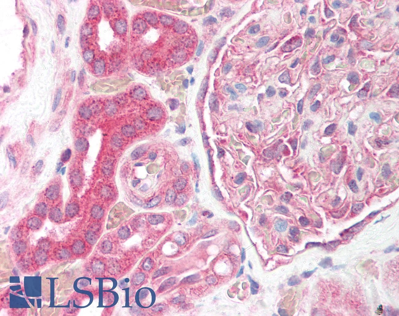 IHC-plus™ Polyclonal Rabbit anti-Human HIF1A / HIF1 Alpha Antibody (aa833-850, IHC, WB)