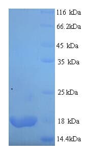 Apium graveolens Api g 1, Isoallergen 2 Protein (Recombinant His)