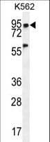 PLEKHA4 Antibody (aa21-50)