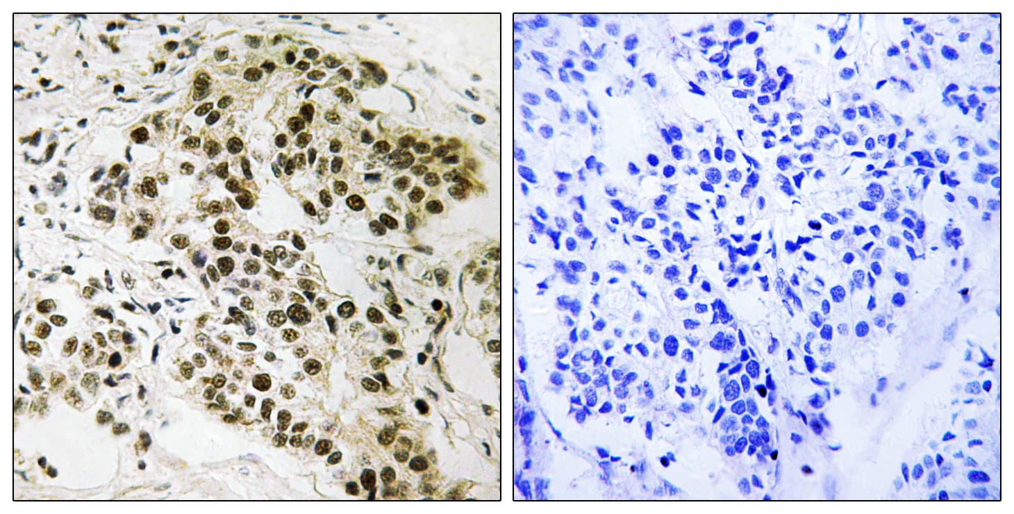 RB1 / Retinoblastoma / RB Antibody (aa221-270)