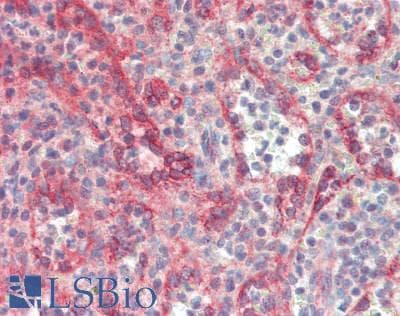 IHC-plus™ SEC23A / COP II Antibody (aa299-328)
