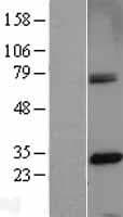 CENPH / CENP-H Protein (Over-Expression Lysate Myc-DDK (Flag))