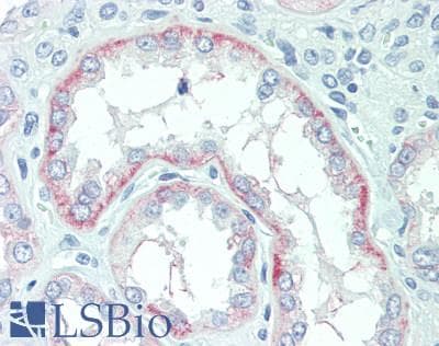 IHC-plus™ Polyclonal Rabbit anti-Human SLC22A2 Antibody (IHC, WB)