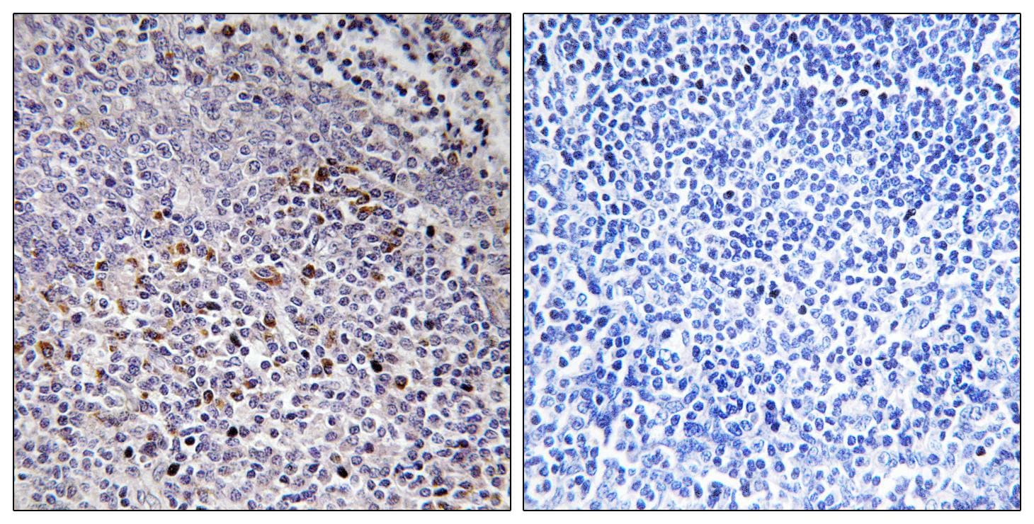 HCCS Antibody