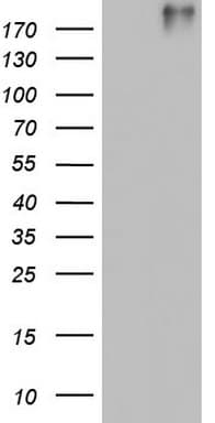 VWF / Von Willebrand Factor Antibody (aa764-1263, clone OTI6D7, Carrier-free)