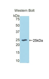 ECT2 Antibody (aa166-348, PE)