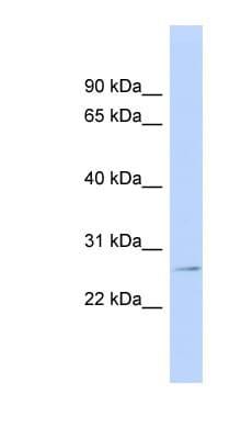GSTP1 / GST Pi Antibody (aa35-84)