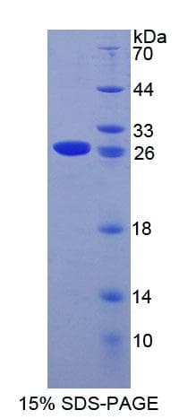 Mouse MCM3 Protein (Recombinant His-T7, N-terminus)
