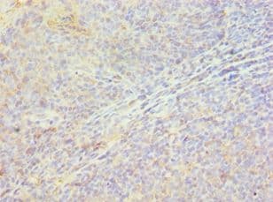 HSPB8 / H11 / HSP22 Antibody (aa1-196)